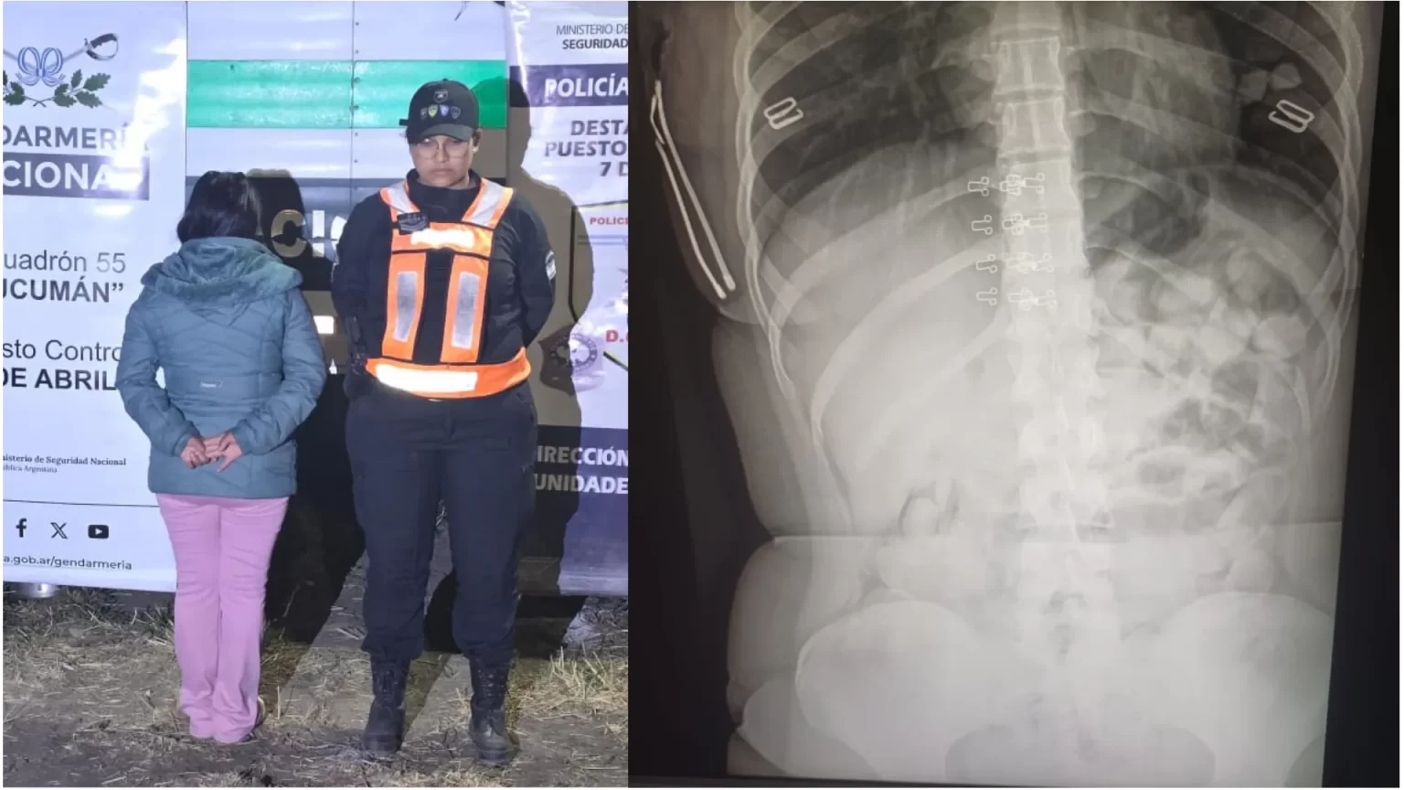 Una pasajera boliviana fue detenida en Tucumán tras ingerir 90 cápsulas de cocaína en el estómago