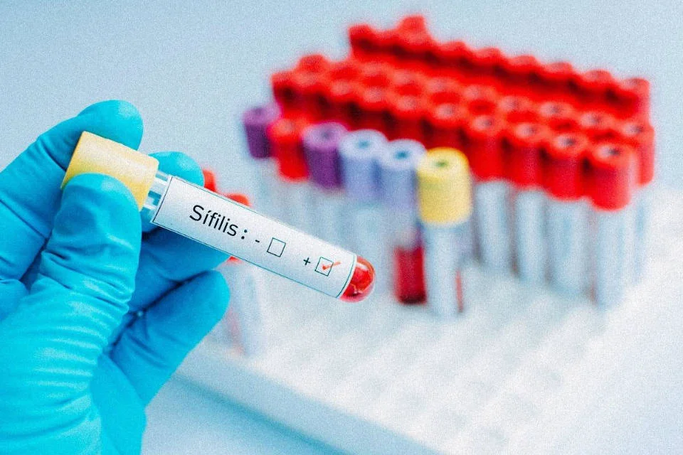 Alerta sanitaria en Salta: crecen los casos de sífilis y la mitad afecta a jóvenes de entre 20 y 29 años