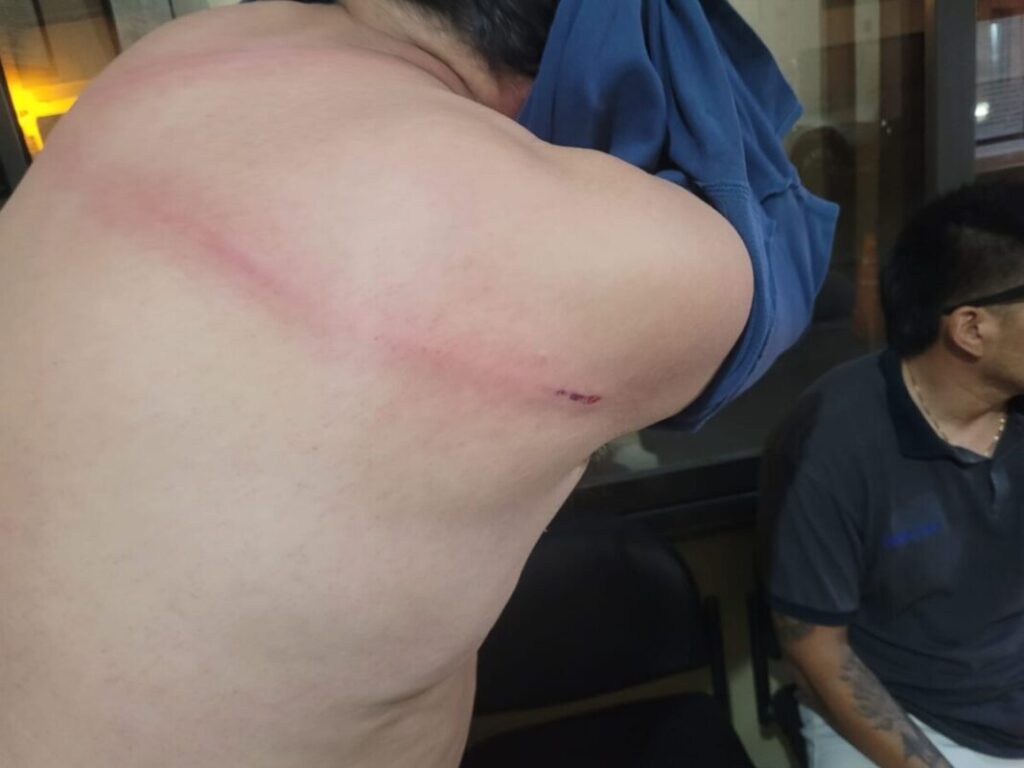 Solicitan prisión preventiva para padre e hija por agredir a un inspector municipal