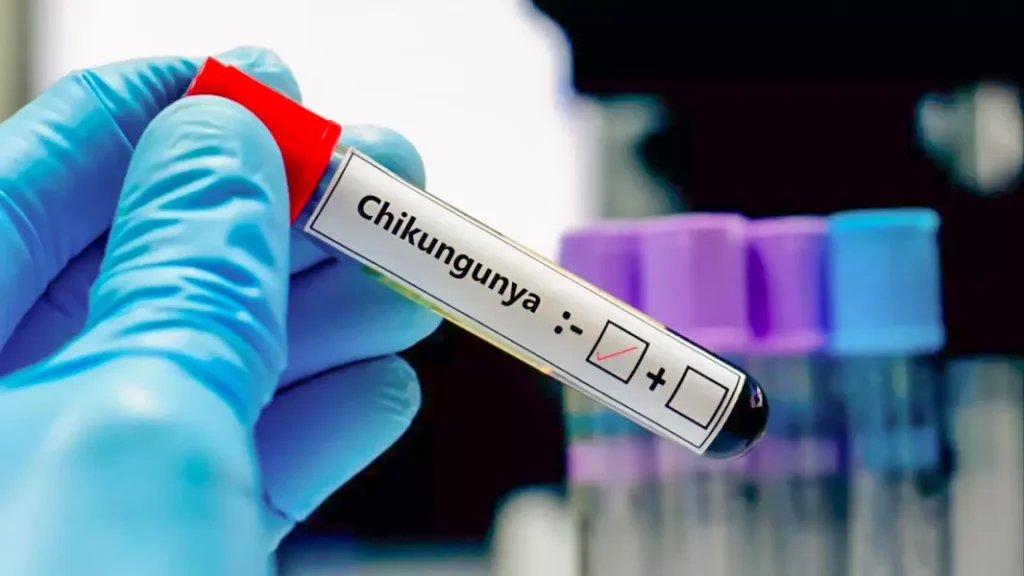 Chikungunya en Salta: advierten por más casos tras las lluvias y las inundaciones