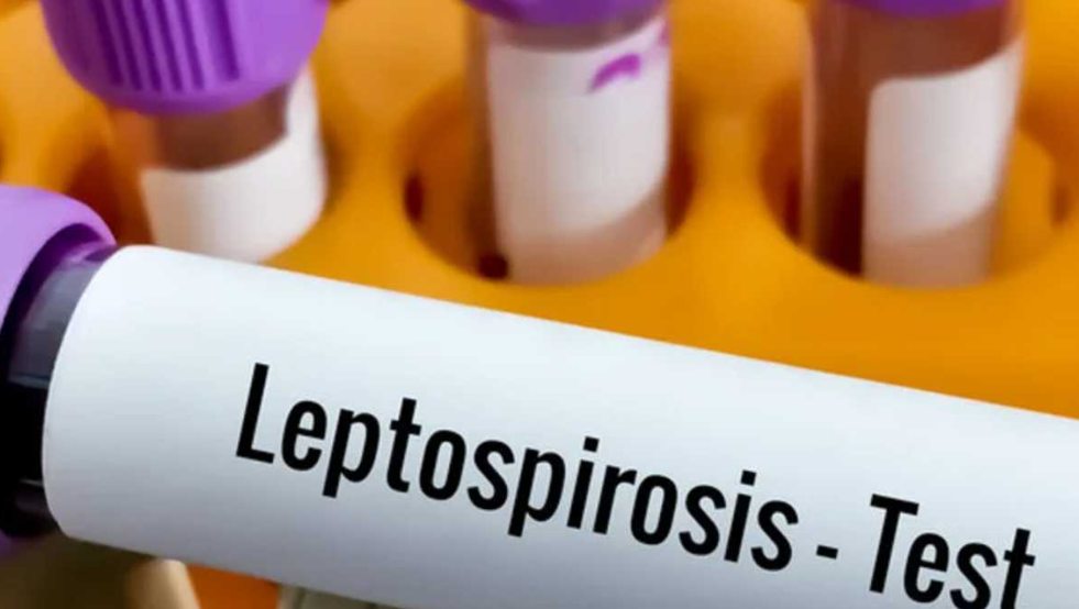 Se confirmó un fallecido por leptospirosis en Córdoba